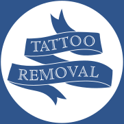 Tattoo Removal